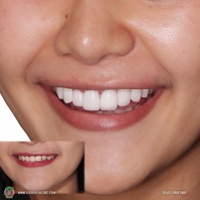 get-your-smile-here--1